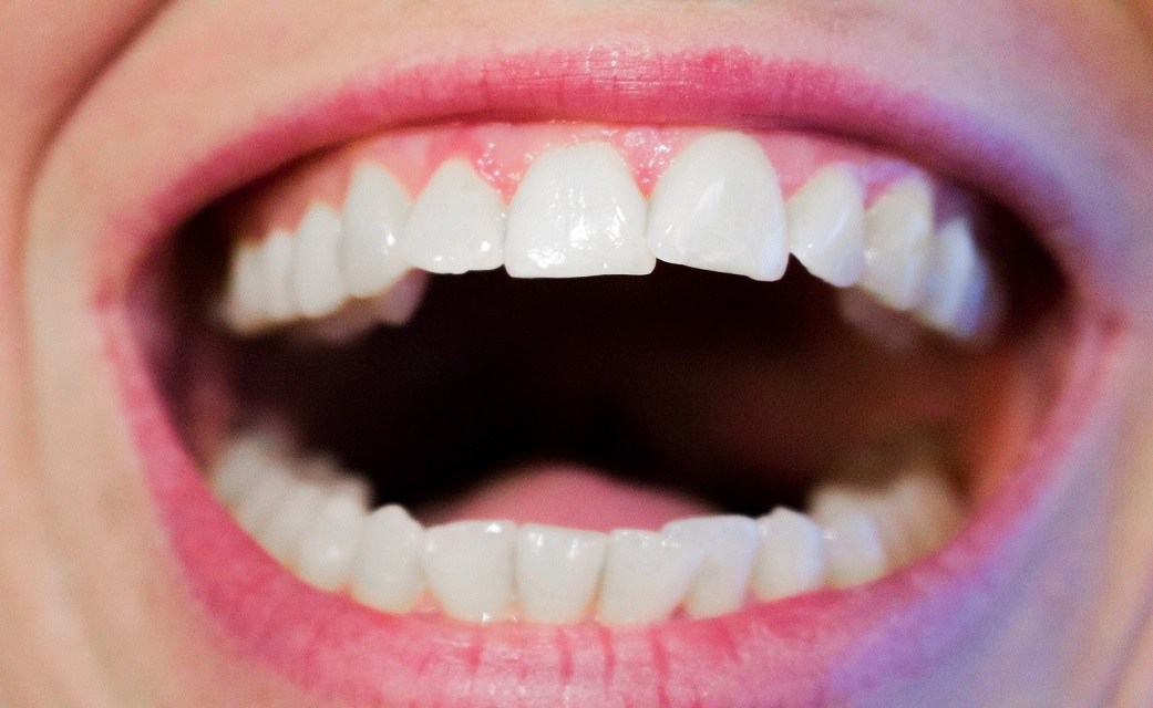 How to keep up with good oral health