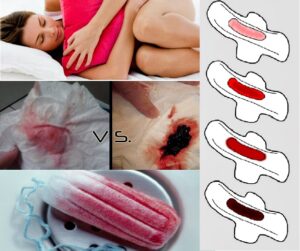 What does menstrual blood color say about your health
