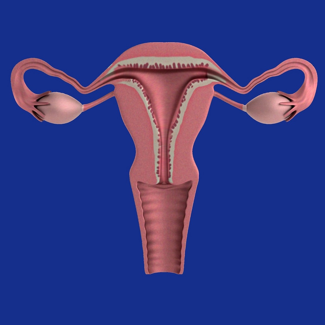 ovarian cancer symptoms-uterus