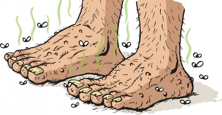 How to remove odor from feet