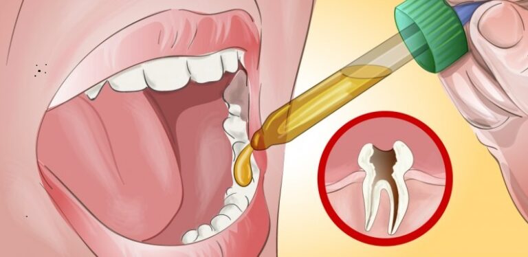 Relieve toothache