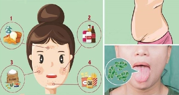 7 Signs That Scream You Need Getting Rid Of Toxins In Your Body!