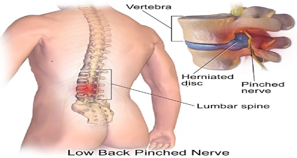 spinal adjustment