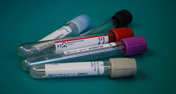 Can cancer be detected in blood test