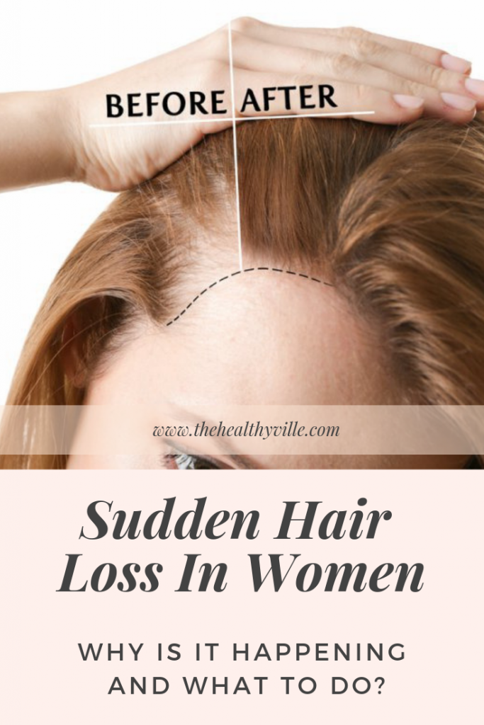 Sudden Hair Loss In Women – Why Is It Happening And What To Do