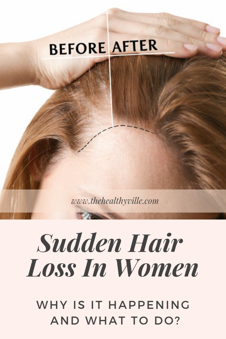 Sudden Hair Loss In Women – Why Is It Happening And What To Do?