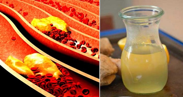 Control High Levels Of Cholesterol In The Blood And Hypertension Using This Remedy!