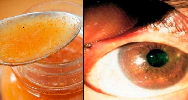 kinds of eye diseases