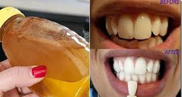 natural teeth whitening tips