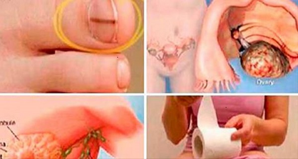 signs you have cancer in your body