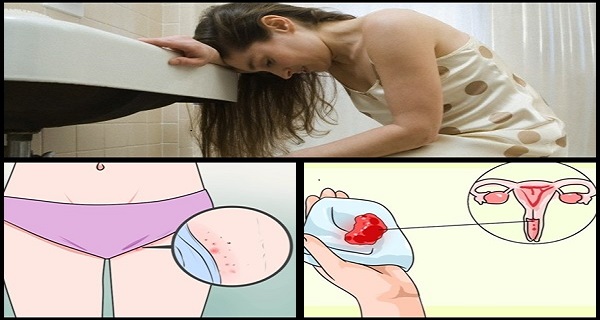 symptoms to cervical cancer