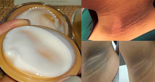 How to clear dark skin on neck