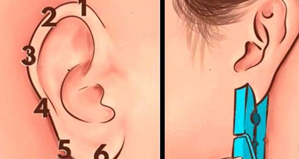 Pressure point in ear for headache