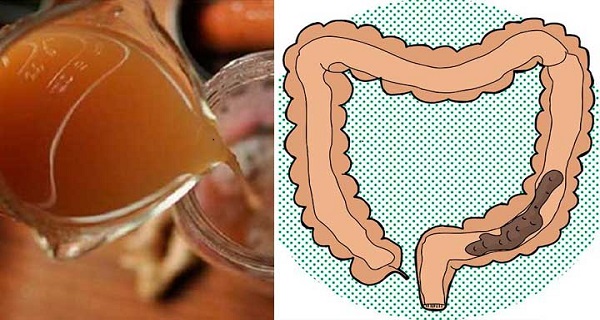 If You Have Constipation Problems, Clean Your Bowel Using This!