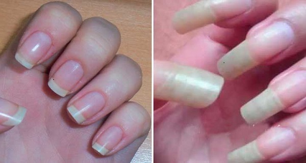 how to make nails grow fast and strong