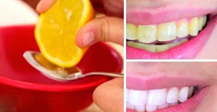 how to whiten teeth quickly at home