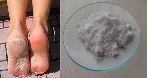 best way to heal cracked feet