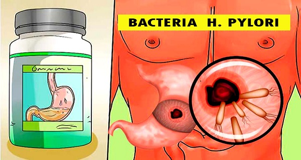 bacteria H pylori symptoms