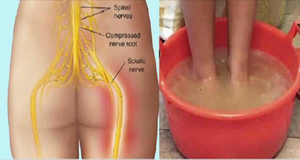 sciatic nerve and leg pain