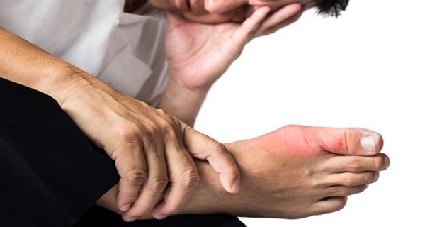 joint pain due to uric acid