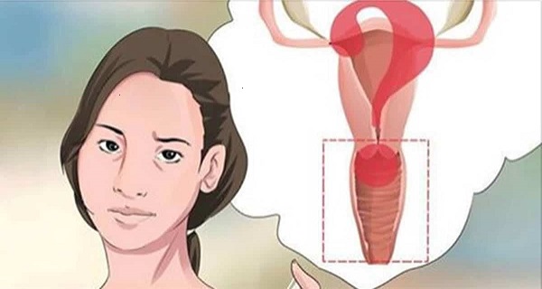 pre menopause symptoms list