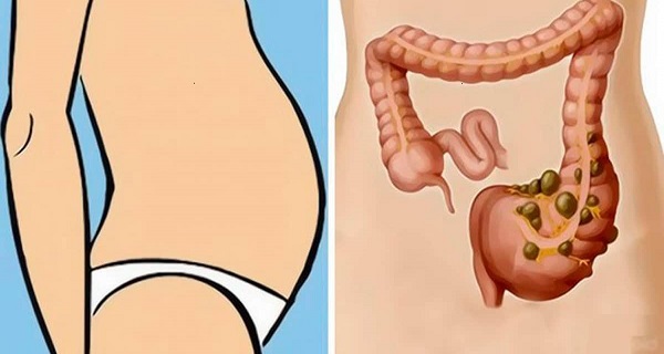 Your Stomach Feels Full And Bloated? Is It Because Of Fat Or Stomach Heaviness? Let’s Find Out!