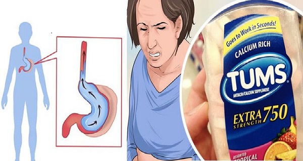 antacid tablets neutralize stomach acid