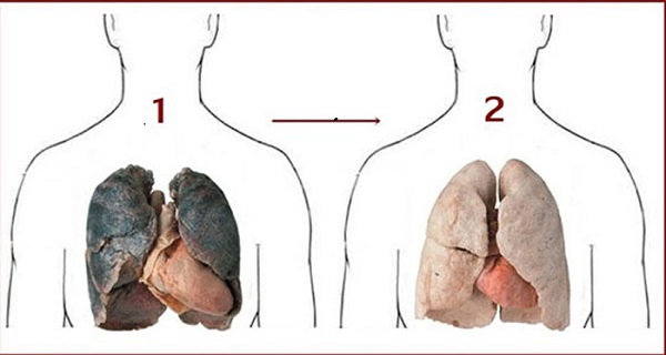 how to detox your lungs after quitting smoking
