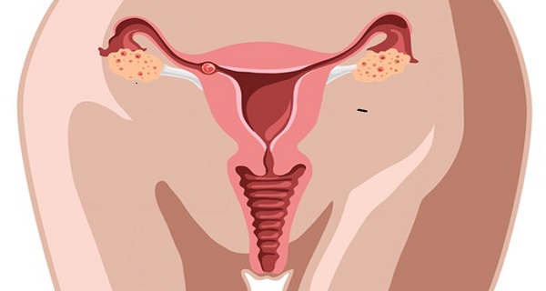 possible causes of cervical cancer