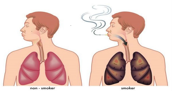 the damage of smoking