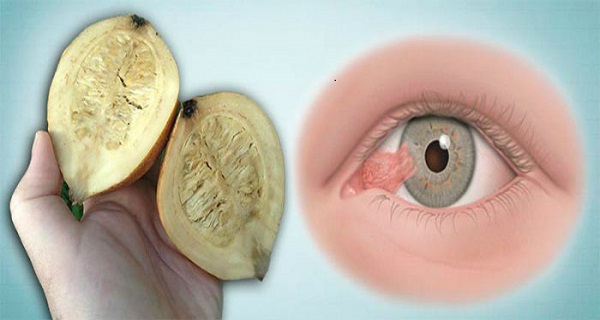treatment for uveitis of the eye
