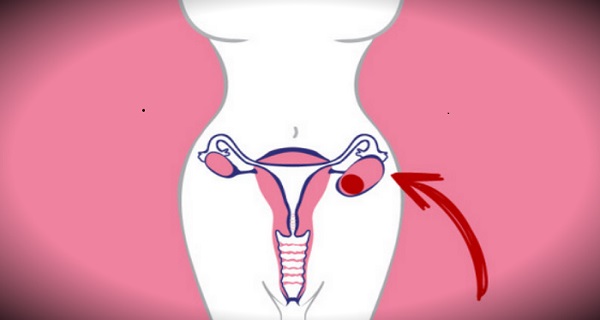 early signs of fibroids