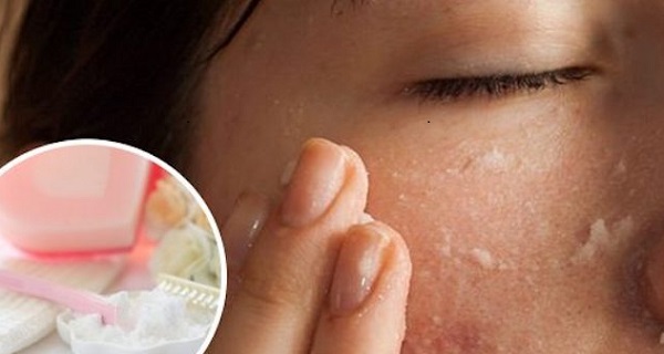 Use Baking Soda To Exfoliate Face – Prepare This Face Mask With Baking Soda And Lemon