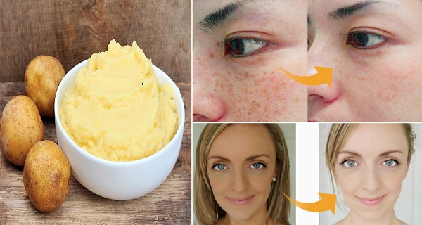 Learn How To Lighten Skin Naturally Using Potato – 4 Different Recipes With The Same Lightening Effect