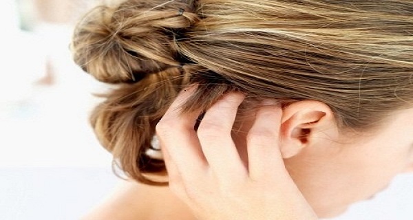 What Causes It And How Do You Get Rid Of Dandruff?
