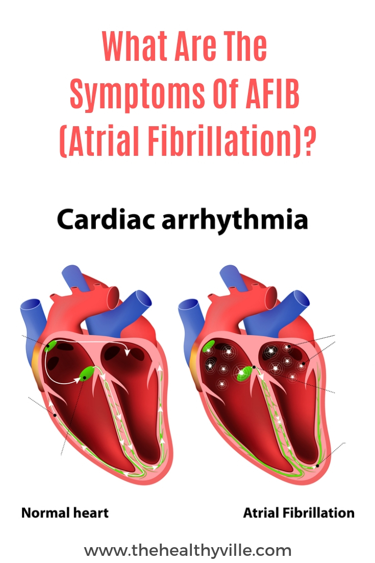 Afib Signs And Symptoms