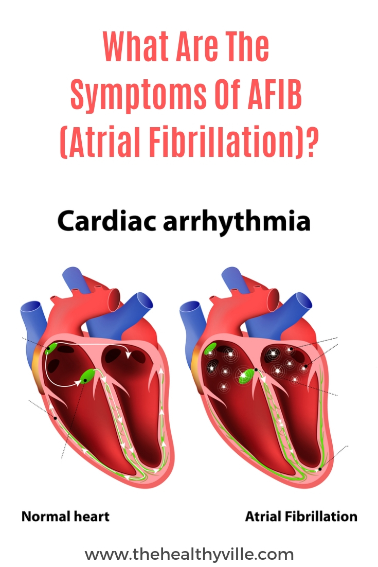 afib-signs-and-symptoms