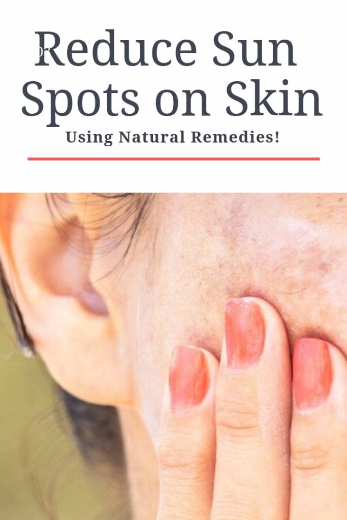 Reduce Sun Spots on Skin Using Natural Remedies!
