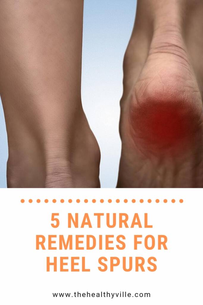 5 Natural Remedies for Heel Spurs