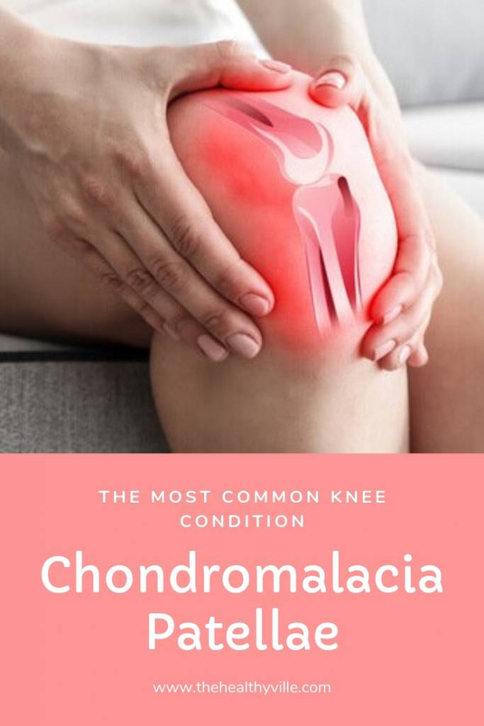 Chondromalacia Patellae, the Most Common Knee Condition