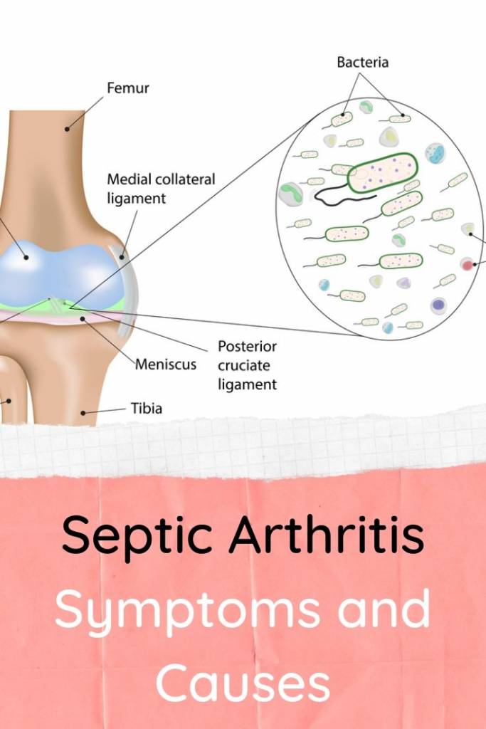 Septic Arthritis Symptoms and Causes