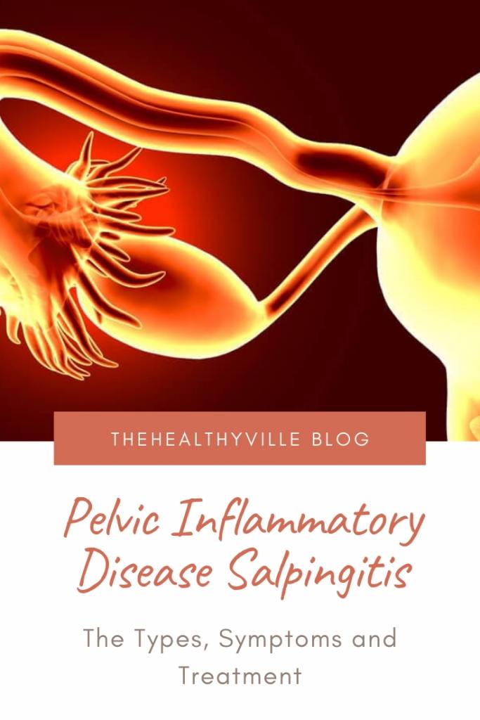 The Types, Symptoms and Treatment of the Pelvic Inflammatory Disease Salpingitis