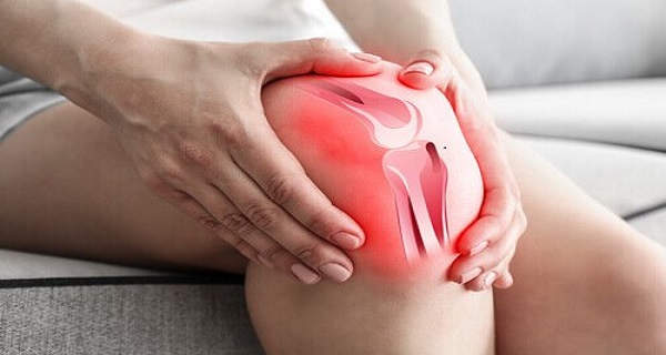 chondromalacia patellae