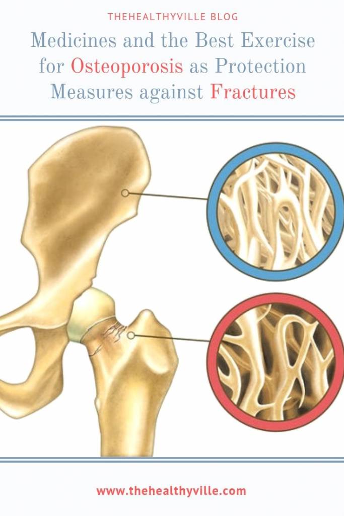 Medicines and the Best Exercise for Osteoporosis as Protection Measures against Fractures
