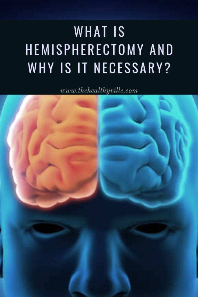 What Is Hemispherectomy And Why Is It Necessary