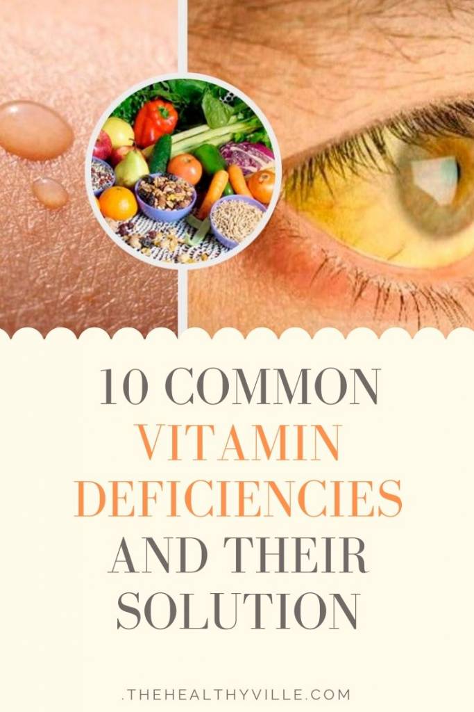 10 Common Vitamin Deficiencies and Their Solution