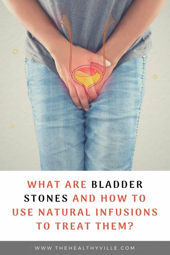 What Are Bladder Stones and How to Use Natural Infusions to Treat Them_