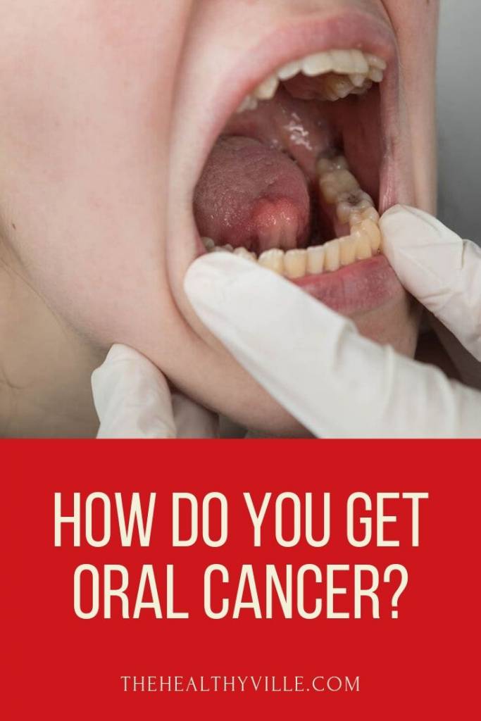 How Do You Get Oral Cancer_ – Know the Risk Factors!