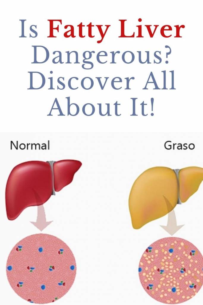 Is Fatty Liver Dangerous_ Discover All About It!
