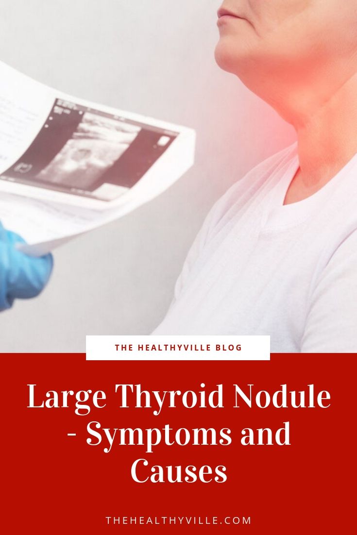 Thyroid Nodule Symptoms Pictures Treatment Causes Hot Sex Picture